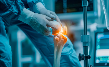 The Role of AI in Modern Joint Replacement Procedures